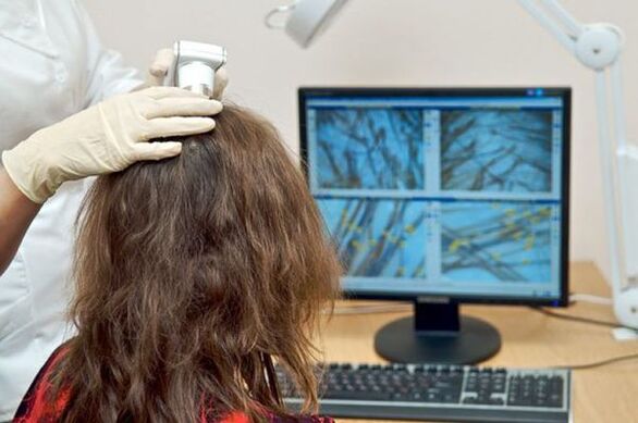 Diagnosztikai trichoszkópia elvégzése