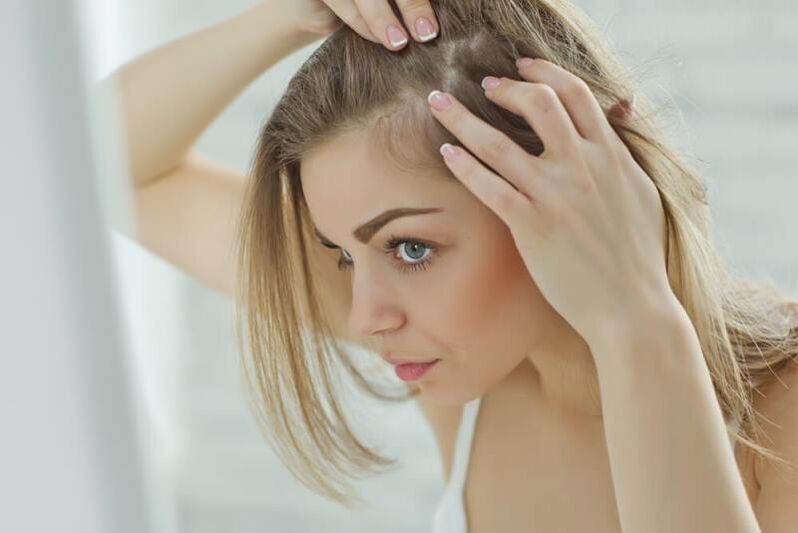 Egy lány az alopecia gócait vizsgálja